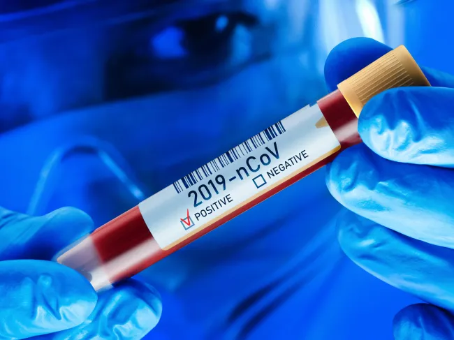 cases positive testing covid